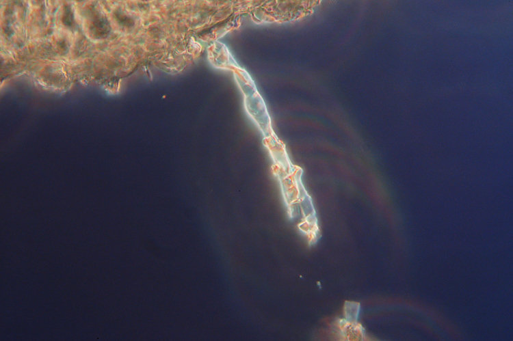 Due croste forse una su abete-foto0555(Hyphoderma setigerum)